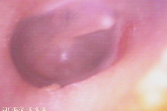 Otoscope vidéo numérique 720X480