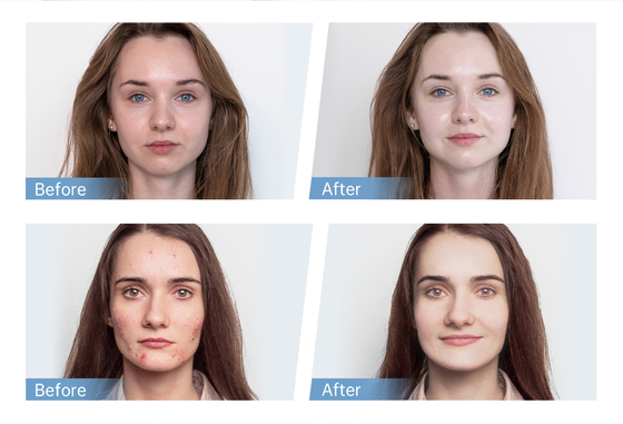 Dernier applicateur de sérum automatique EMS 4 pôles Hydra Pen H5 pour le visage, stylo de microneedling dermique pour la peau, régénération de l'essence de collagène