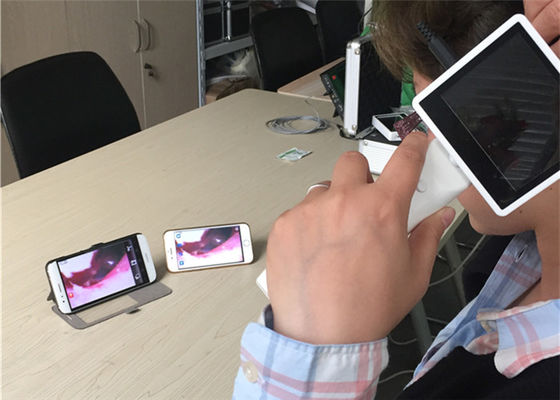 Otoscope vidéo numérique 720X480