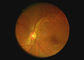 Endoscope visuel de Dermatoscope Digital d'otoscope de matériel optique de caméra ophtalmique de gorge avec 2 millions de pixels