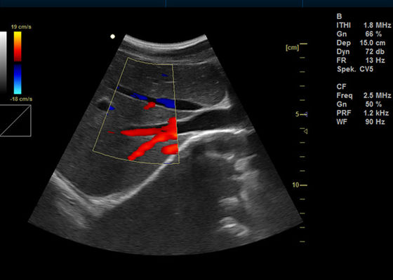 Machine à doppler numérique à couleur complète