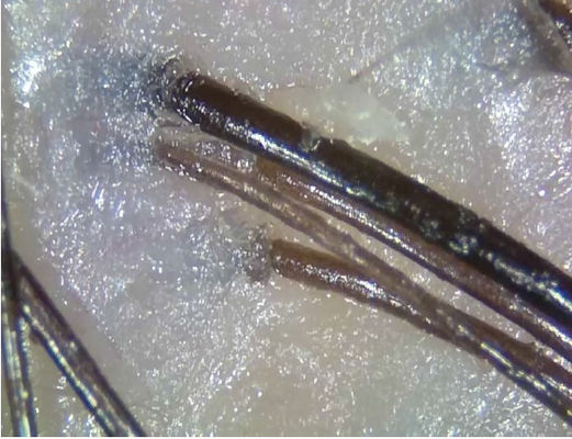 Analyseur de peau numérique portable sans fil