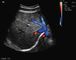 Scanner portatif d'ultrason de grossesse avec les transducteurs Transvaginal convexes abdominaux