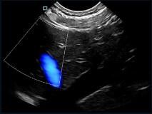 Sonde tenue dans la main de Doppler de couleur de scanner d'ultrason de mini poche variable avec la fréquence de 2~11MHz