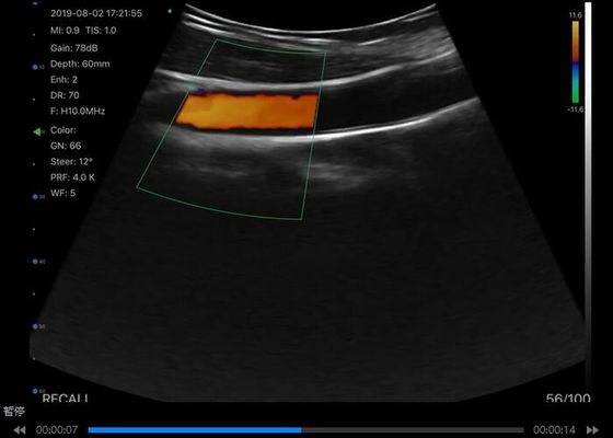 Scanner d'échographie portatif sans fil numérique