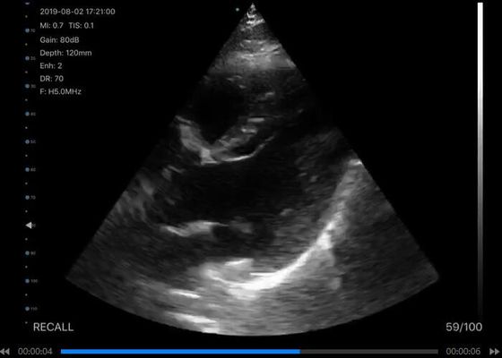 Scanner d'échographie portatif sans fil numérique