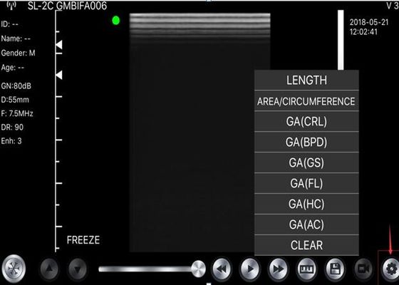 corps convexe tenu dans la main de scanner de l'ultrason 5G : 3.5~5MHz, linéaire : 7.5~10MHz, cardiaque : 2.5~5MHz