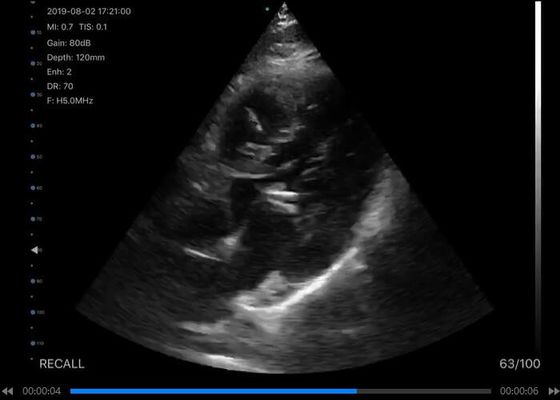corps convexe tenu dans la main de scanner de l'ultrason 5G : 3.5~5MHz, linéaire : 7.5~10MHz, cardiaque : 2.5~5MHz