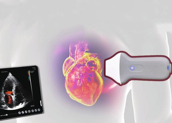 Élément portatif du scanner 128 d'ultrason de radio de PDI WiFi